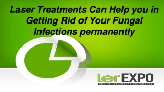 Laser Treatments Can Help you in Getting Rid of Your Fungal Infections permanently