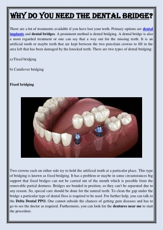 Why do you need the dental bridge