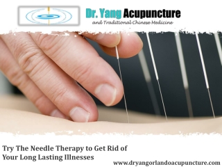 Try The Needle Therapy to Get Rid of Your Long Lasting Illnesses