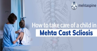 How to take care of a child in Mehta Cast Scoliosis - Mehta Spine