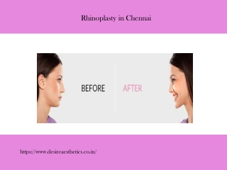 Rhinoplasty in Chennai