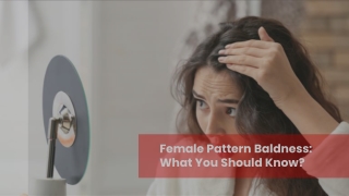 Female Pattern Baldness_ What You Should Know_