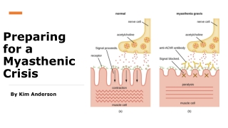 Myasthenia gravis