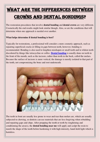 What Are the differences Between Crowns and Dental Bondings