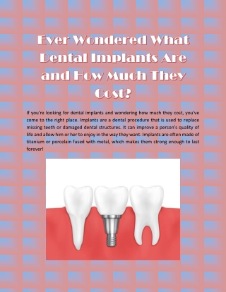 Ever Wondered What Dental Implants Are and How Much They Cost?