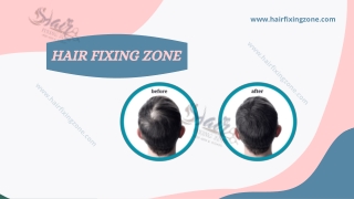 Best and Latest Hair Loss Treatment for Men