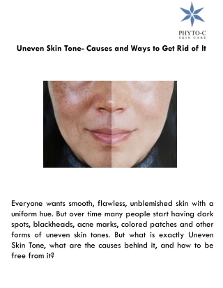 Uneven Skin Tone- Causes and Ways to Get Rid of It