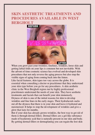 SKIN AESTHETIC TREATMENTS AND PROCEDURES AVAILABLE IN WEST BERGHOLT