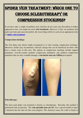 Spider vein Treatment Which One To Choose Sclerotherapy Or Compression Stockings