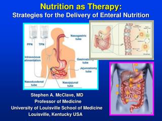 Nutrition as Therapy: Strategies for the Delivery of Enteral Nutrition