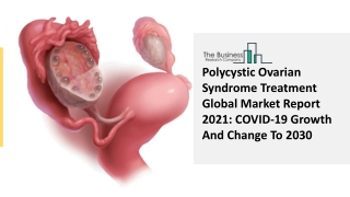 Global Polycystic Ovarian Syndrome Treatment Market Insights, Trends