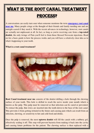 What is the Root Canal Treatment Process