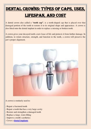 Dental Crowns Types of Caps, Uses, Lifespan, and Cost