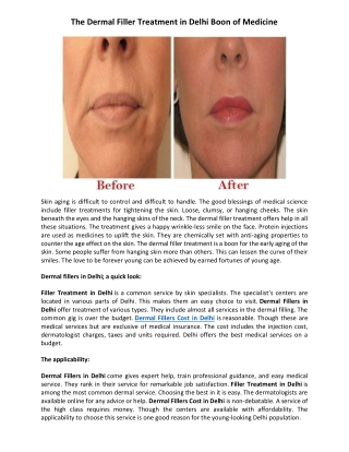 The Dermal Filler Treatment in Delhi Boon of Medicine