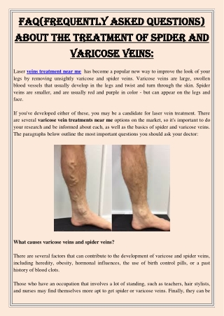 FAQ(Frequently Asked Questions) About The Treatment of Spider And Varicose Veins