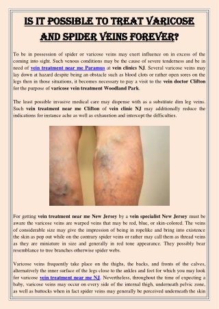 Is It Possible To Treat Varicose and Spider Veins Forever