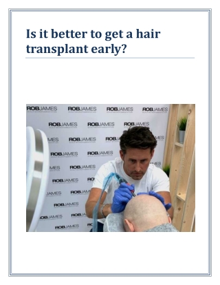 Is it better to get a hair transplant early