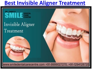 Get Best Invisible Aligner Treatment in Faridabad Smile Dental Care Centre