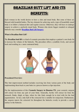 Brazilian Butt Lift and Its Benefits