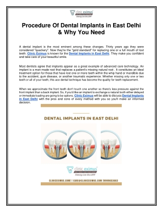Procedure Of Dental Implants in East Delhi & Why You Need