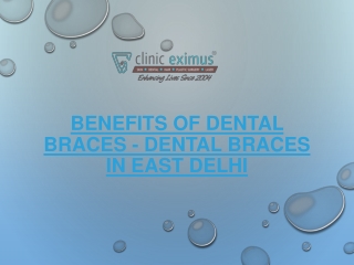 Benefits of Dental Braces - Dental Braces in East Delhi