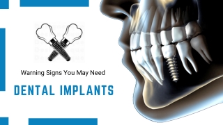 Impressive Implants For Oral Health