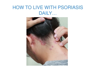 HOW TO LIVE WITH PSORIASIS DAILY…