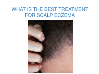 WHAT IS THE BEST TREATMENT FOR SCALP ECZEMA