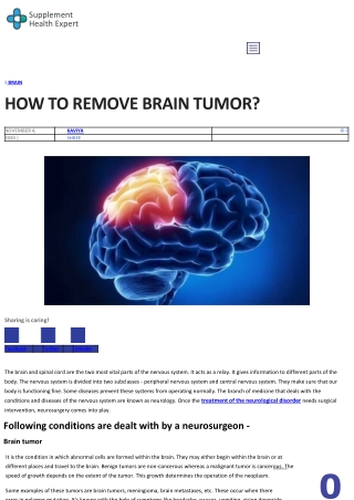 How to Remove Brain Tumor?