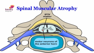 Spinal Muscular Atrophy