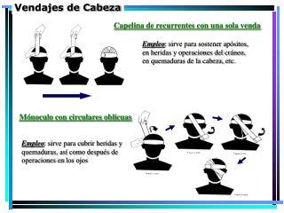Vendajes de Cabeza
