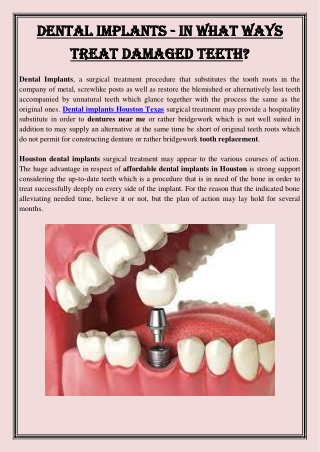 Dental Implants - In What Ways Treat Damaged Teeth