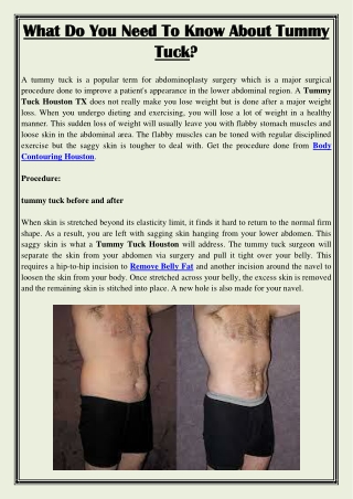 What Do You Need To Know About Tummy Tuck