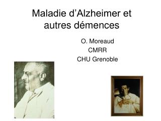 Maladie d’Alzheimer et autres démences