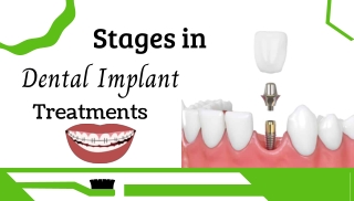 Procedures for Replacement of Teeth
