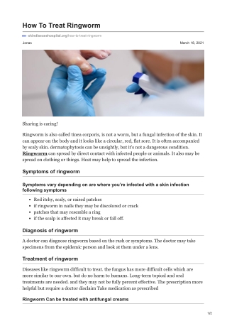 How To Treat Ringworm?