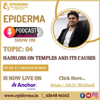 Epiderma Podcast Show about Hairloss on Temples and its Causes - Epiderma Clinic