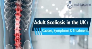 Adult Scoliosis in the UK Causes  Symptoms Treatment