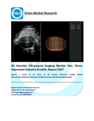 3D Vascular Ultrasound Imaging Market Size, Share, Industry Growth, Report 2027