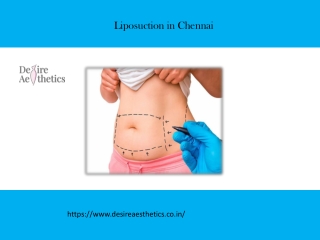 Liposuction in Chennai