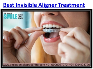 Best Invisible Aligner Treatment in Faridabad How is Possible to Get?