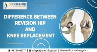 Difference between Revision Hip and Knee Replacement | Dr Chirag Patel