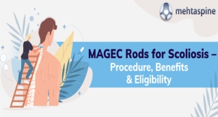 MAGEC Rods for Scoliosis – Procedure, Benefits & Eligibility | Mehta Spine