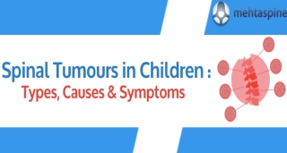 Spinal Tumours in Children: Types, Causes & Symptoms | Mehta Spine