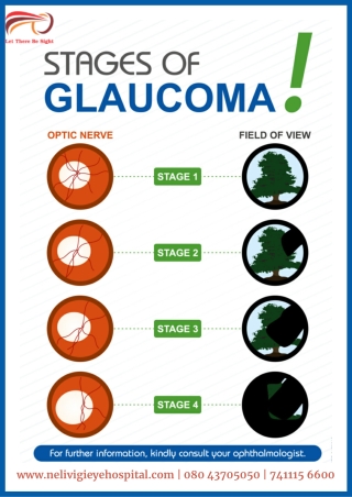 Stage of Glaucoma | Best Eye Hospitals in Bellandur, Bangalore | Nelivigi Eye