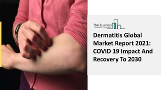 Dermatitis Market Growth Analysis, Latest Trends And Business Opportunity 2030