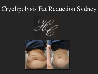 Cryolipolysis Fat Reduction Sydney