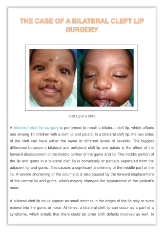 The Case of a Bilateral Cleft Lip Surgery | Richardson Hospital