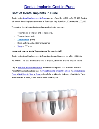 Dental Implants Cost in Pune