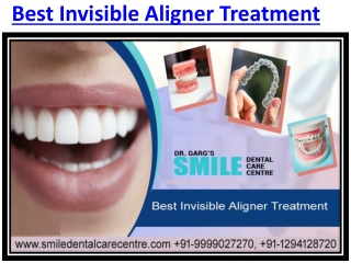 Best Invisible Aligner Treatment in Affordable Price in Faridabad